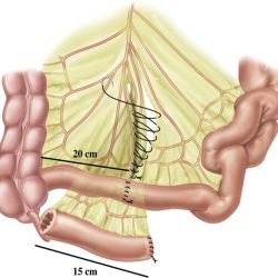 Related to the small intestine crossword clue